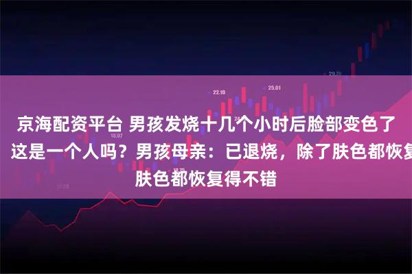 京海配资平台 男孩发烧十几个小时后脸部变色了!网友:这是一个人吗?男孩母亲:已退烧,除了肤色都恢复得不错